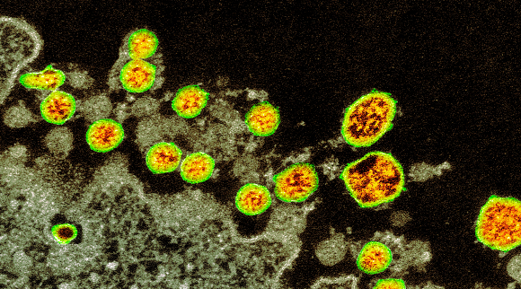 נגיפי SARS-CoV-2 (צהוב) בצילום במיקרוסקופ אלקטרונים | מקור: CDC / SCIENCE PHOTO LIBRARY
